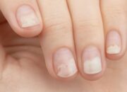 Kenali Kuku Tak Sehat, Bisa Jadi Sinyal Penyakit