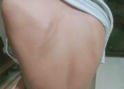 Warga Medan Dianiaya Saat Angkut Bantuan untuk Korban Banjir, Punggung Dicambuk Sabuk