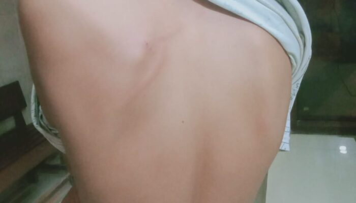 Warga Medan Dianiaya Saat Angkut Bantuan untuk Korban Banjir, Punggung Dicambuk Sabuk