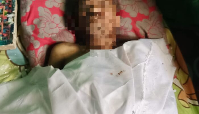 Penemuan Mayat Pria di Pajak Baru Perbaungan Bikin Geger, Polisi: Tak Ada Tanda Kekerasan