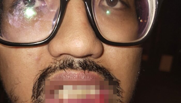 Cucu di Medan Aniaya Sepupunya Saat Suasana Berduka